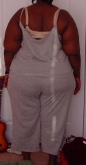 3-24-2008 (c)
Day of surgery Back view. - 
I didn't realize I had a "fold" going down the center of my back! :(