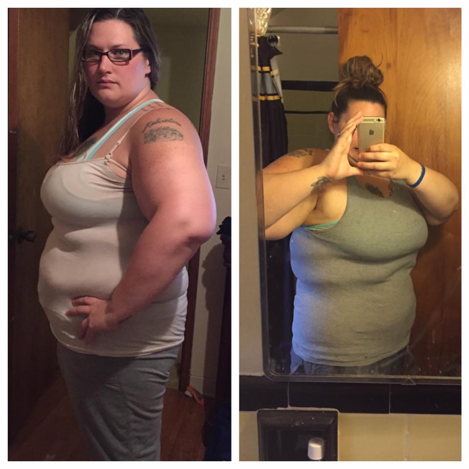 2 weeks post op 