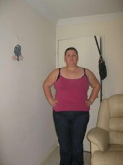 20 05 2009 - 13 days post op