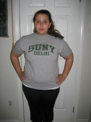 pre-surgery 215?
