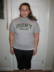 pre-surgery 215?