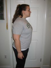 pre-surgery 215?