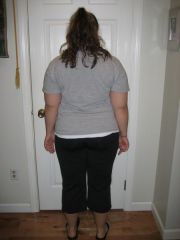 pre-surgery 215?