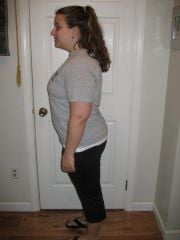 pre-surgery 215?