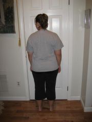 2 months post-op 190