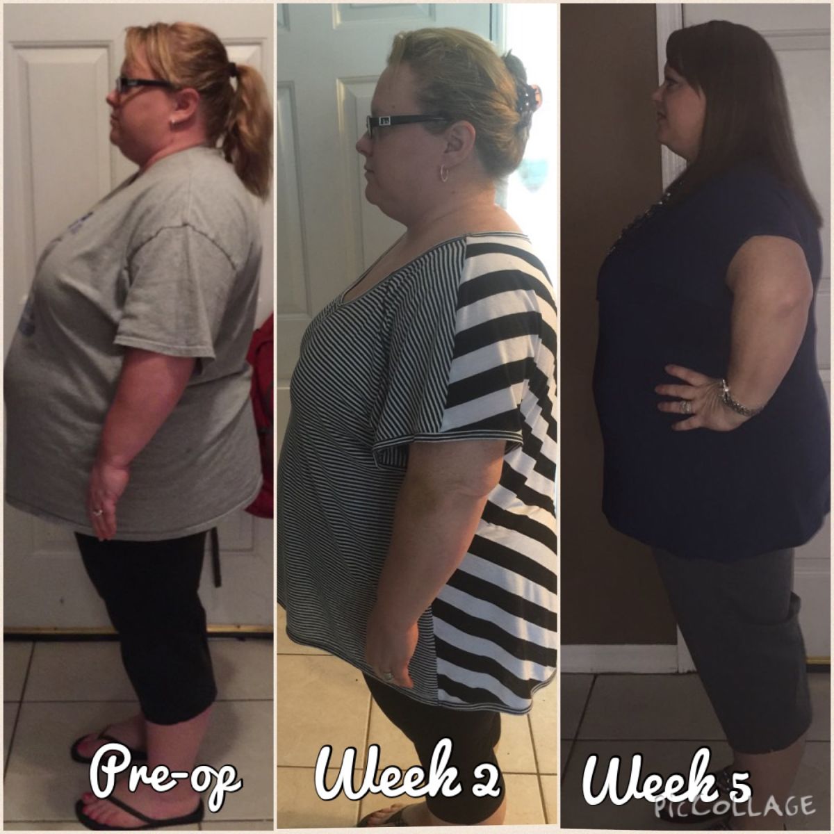 Weight Loss Progress