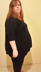 Pre-Surgery Dec 8.JPG