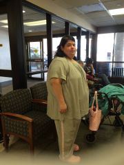 May 20, 2015 Day of surgery - Side view