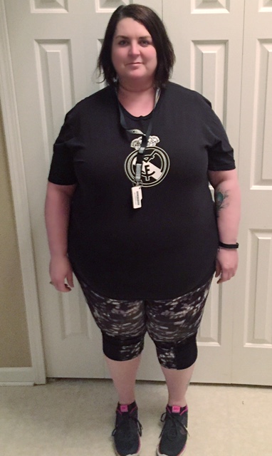 Before Gastric Bypass