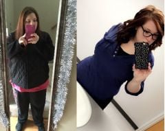Day of Surgery 12/18/15 VS Today 4/20/16
