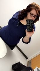 04 20 16 (4 months post op)