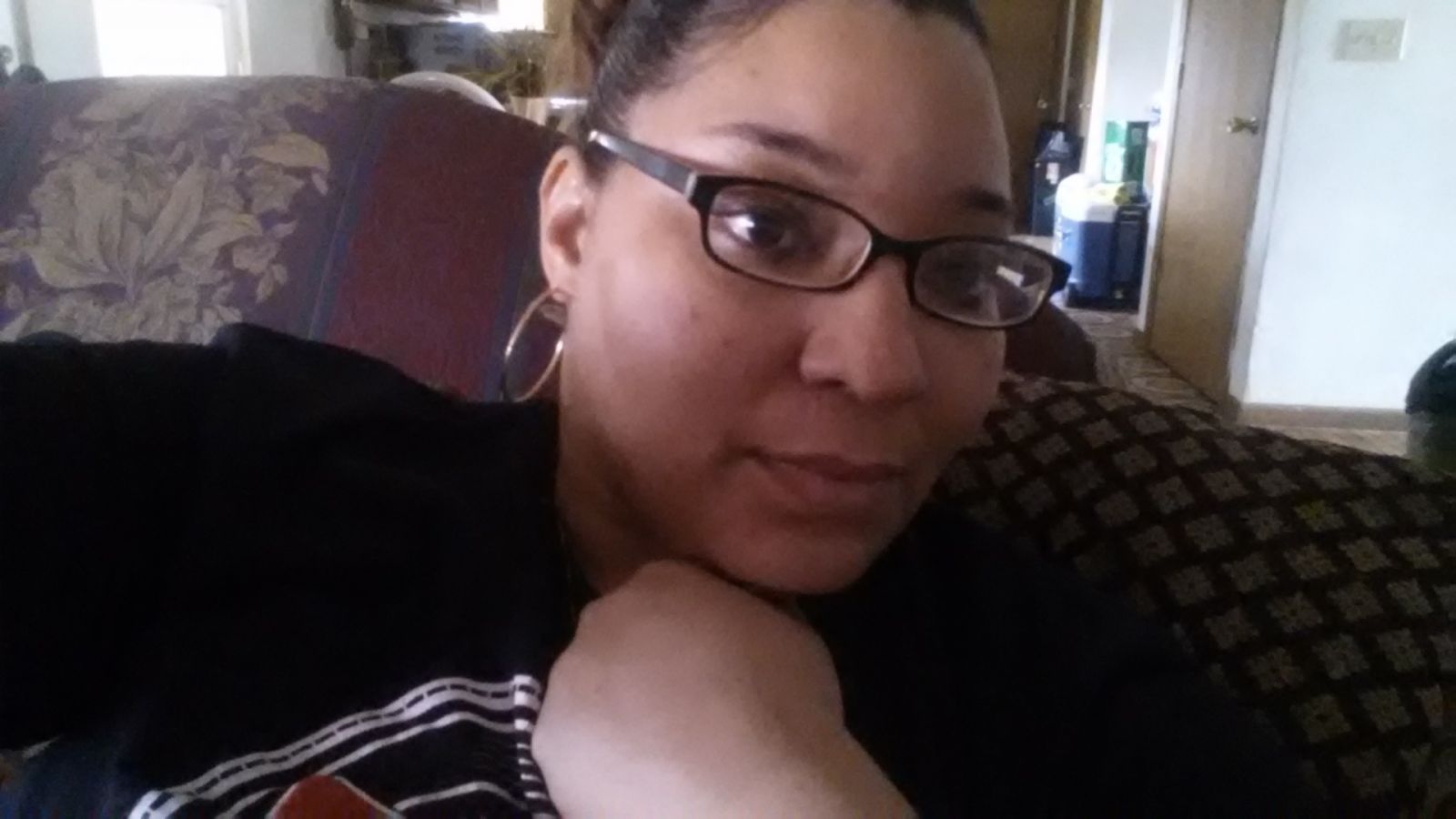 Post Op Pics