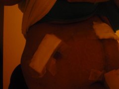 Close up scar#2
