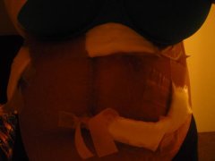 Close up scar#3