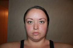 face