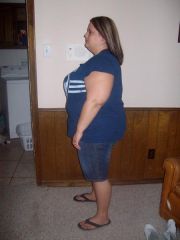 A few weeks before surgery (06/04/09)