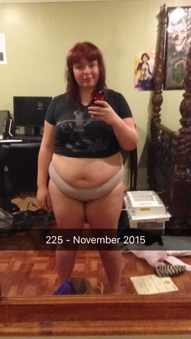 Pre-Surgery Progress
