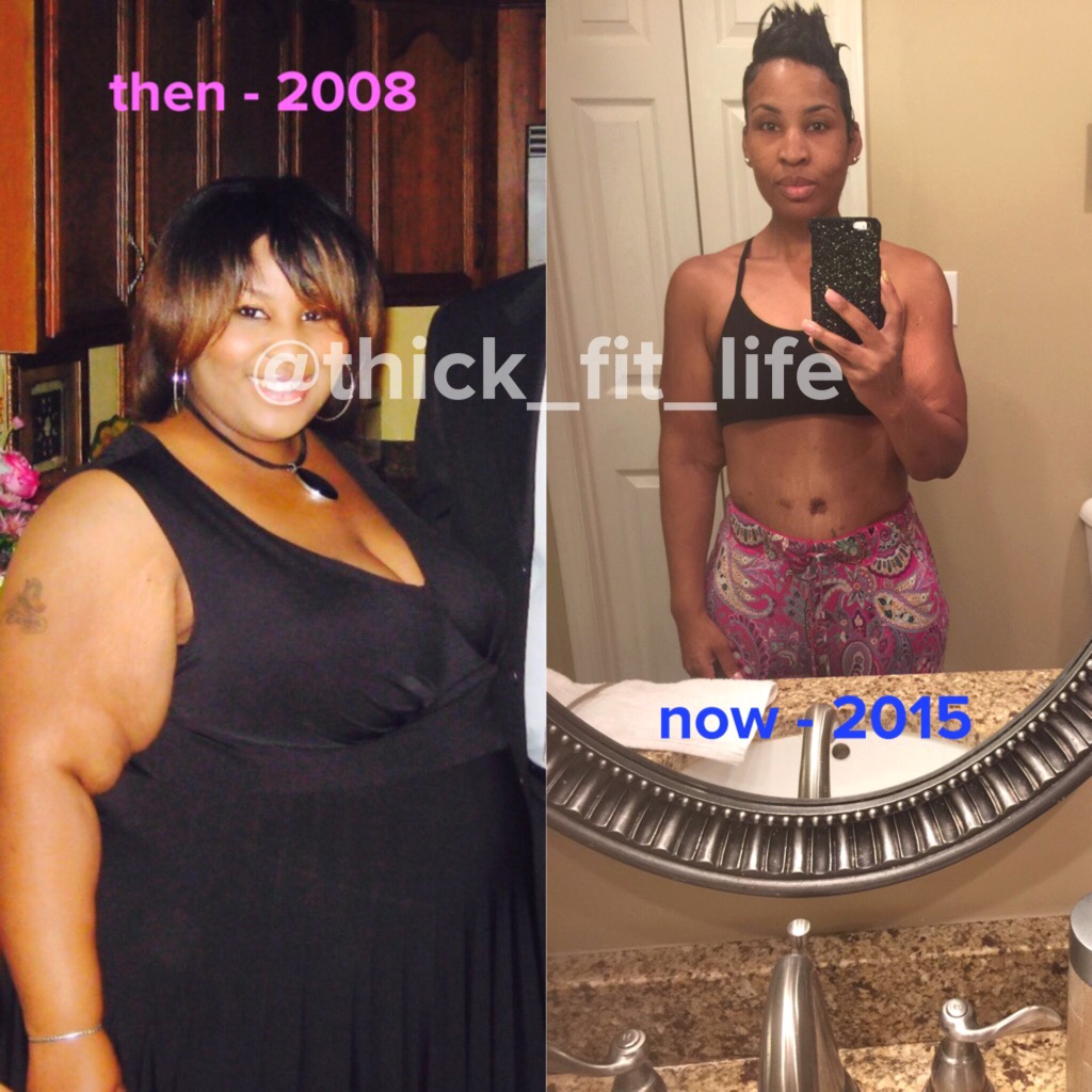bariatricbutterfly
