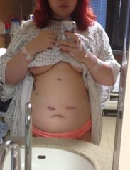 Swollen and bloated, but alive!