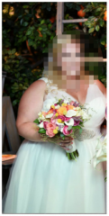 June 2015 (5 months pre-surgery)
