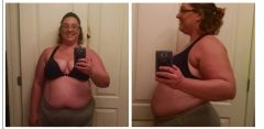 Pre-Op Photos