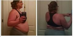 Pre-Op Photos 2