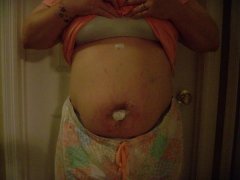 1 day after surgery... my surgeon's first SLIP- Single Incision through the belly button