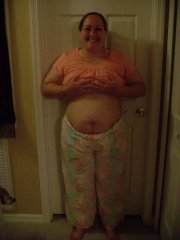 2 wks post op don't see much change...
