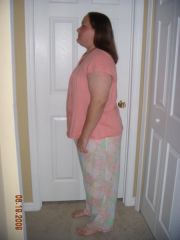 2 wks post op- side view