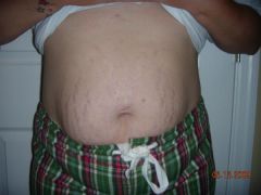 12 wk belly shot