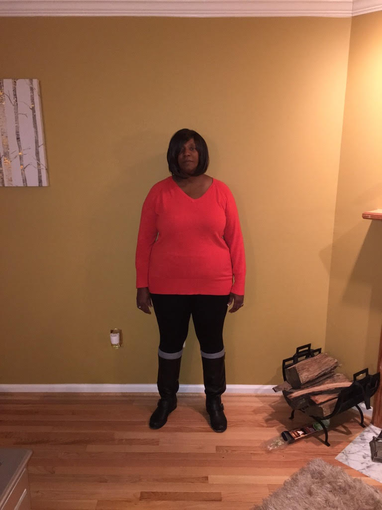 Pre surgery Photos