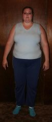 FrontView at 283lbs