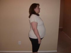 03/10/09 Morning Before Surgery
