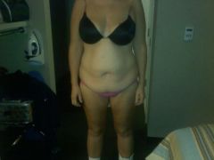 night before plastic surgery 11/18/09