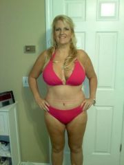 12/09/09 getting a thigh lift 01/28/10