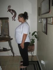 06-19-09 Right after having surgery. 268.5 lbs