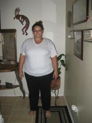 06-19-09 Right after having surgery. 268.5 lbs
