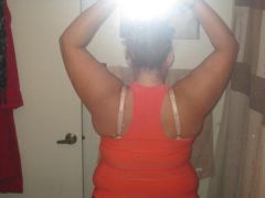 07-17-09 4 wks post op!!!