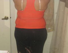 07-17-09 4 wks post op!!!