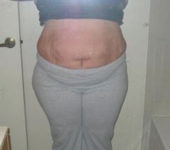 08 02 09 6 wks out