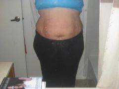 08-14-09 8 wks out