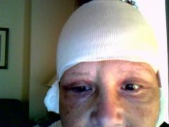 6/30/09
Look mom no stitches in my eyes!
