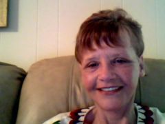 this is 3.5 weeks out from face lift.