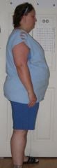 This pic 2 weeks before follow up appt. to get surgery date.
Taken June 28, 2009