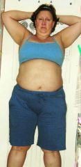 This pic 2 weeks before follow up appt. to get surgery date.
Taken June 28, 2009