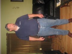 Day before surgery 7/23/09 @ 313