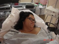 This was right after surgery and I was snoring away!