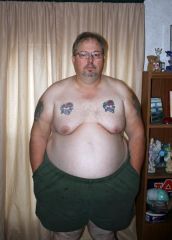 This pictures was taken the night before surgery

Startin weight 383
