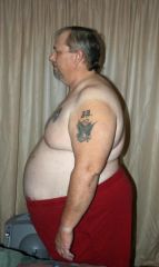 First Month after side shot
