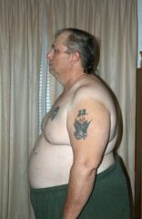 2nd Month side shot